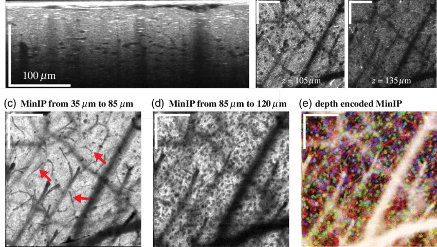 Xf Visocm In Vivo Imaging Of Neural Cells - Tree (850x482), Png Download