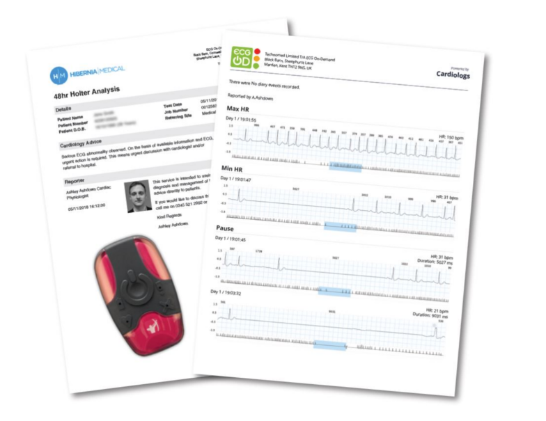 Holter Ecg Heart Monitor - Bugatti Veyron (800x800), Png Download