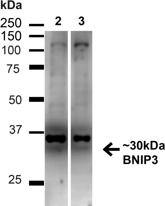 Western Blot - Monochrome (600x699), Png Download