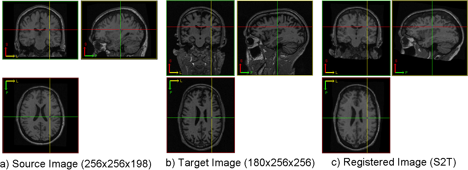 Registration Of Raw Brain Images - Computed Tomography (1590x580), Png Download
