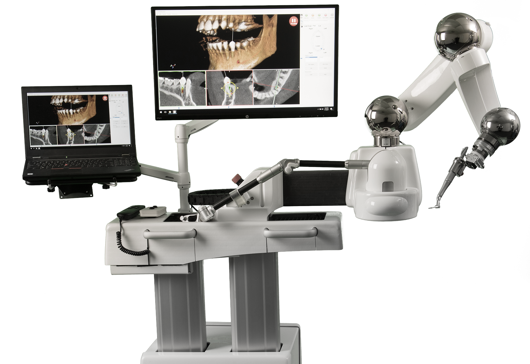 Neocis Wants To Provide Surgeons A Way To Make Dental - Yomi Robot (1707x1173), Png Download