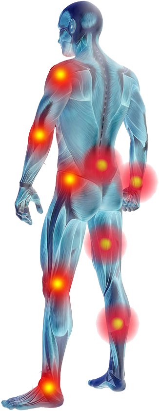 Muscle Pain Remedies - Muscle Pain Png (383x906), Png Download