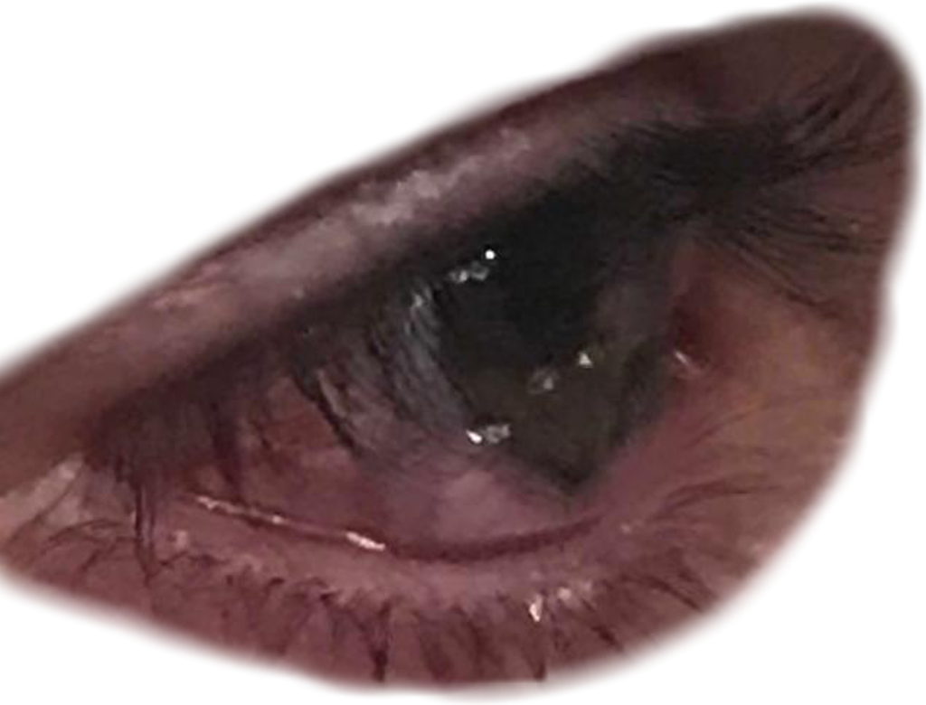 Report Abuse - Close-up (1024x780), Png Download