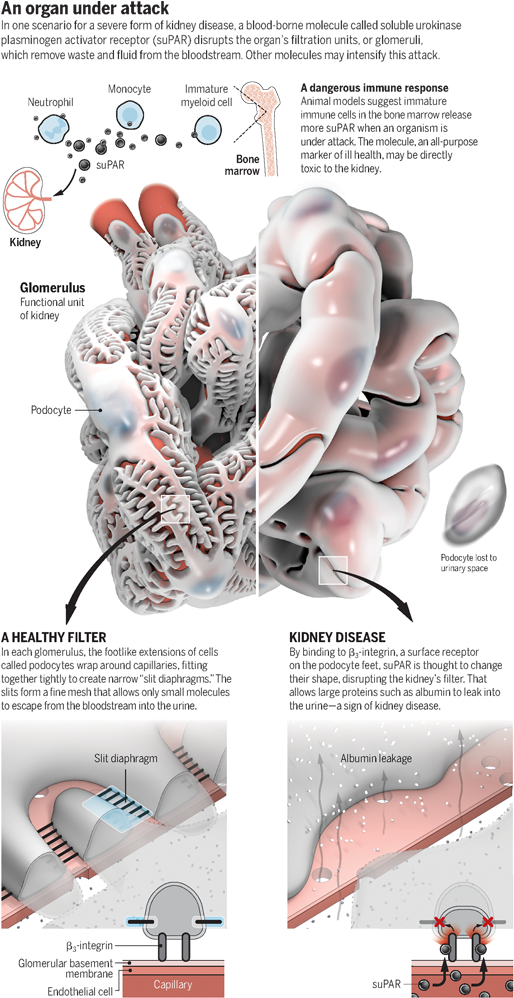 Supar And Kidney Disease - Diagram (750x1000), Png Download