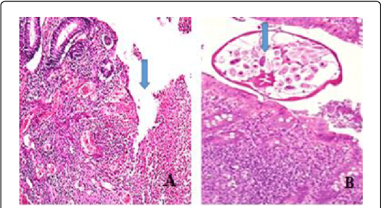 Entrobius Vermicularis In Appendix - Motif (769x419), Png Download