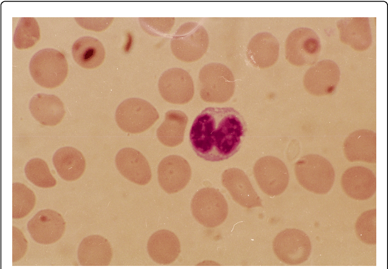 Lymphocyte With A Dumbbell Shaped Nucleus - Circle (769x533), Png Download