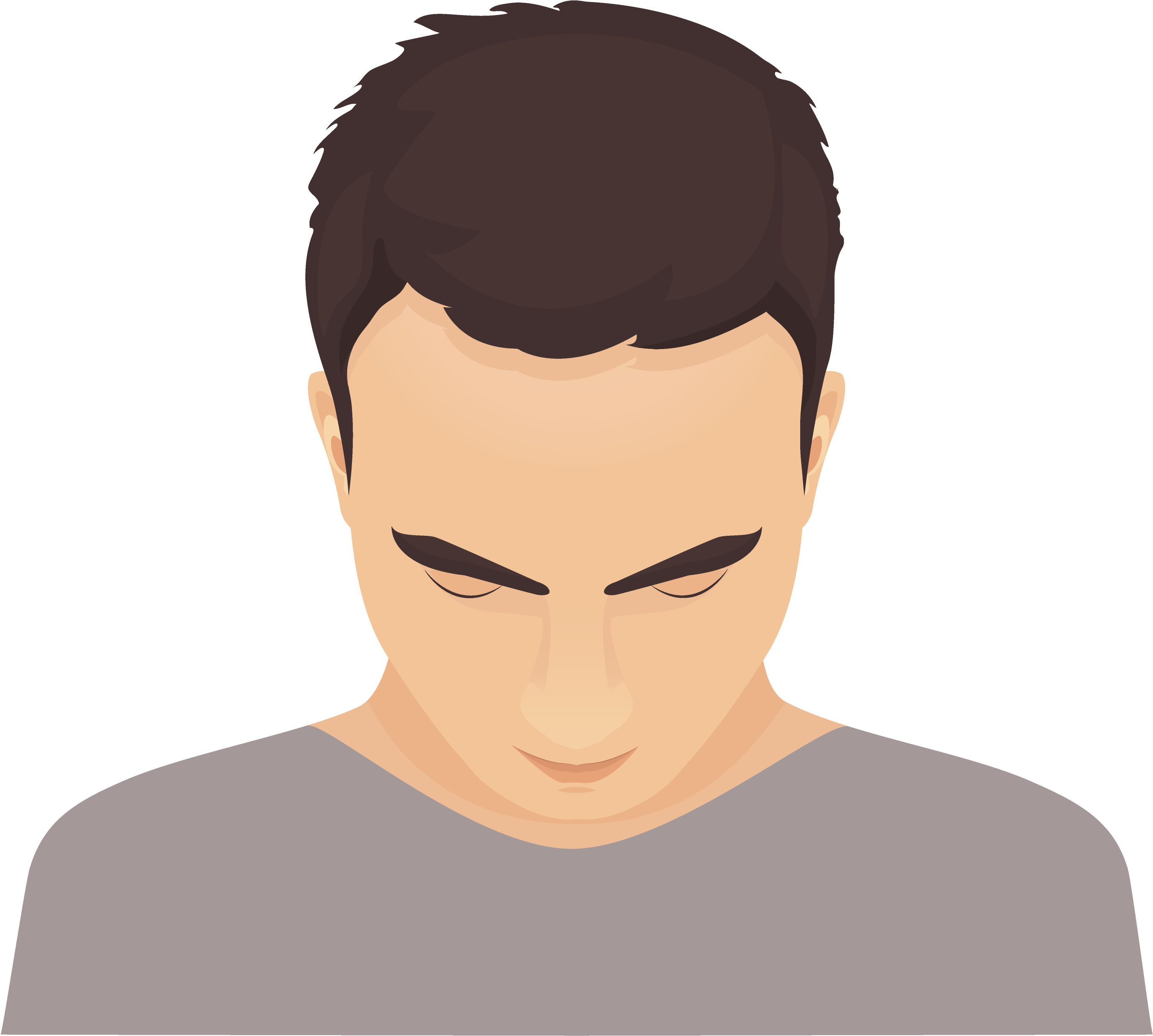 If Baldness Runs In Your Family Either On Your Father - Hair Transplant (3355x3330), Png Download