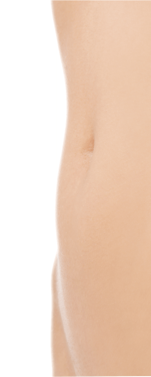 Abdominoplasty - Girl (1160x1280), Png Download