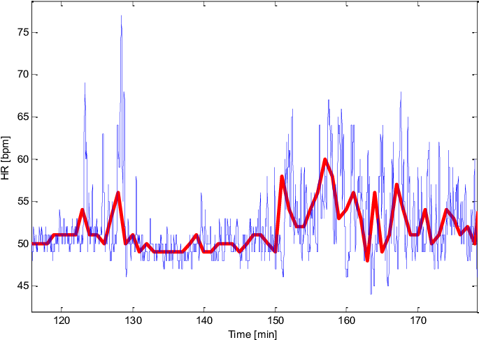 Heart Rate From The Ppg Sensor Of Somnoscreen And Basis - Diagram (720x530), Png Download