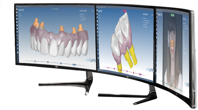 Cad-lynx - 3d Dental Cad (800x457), Png Download