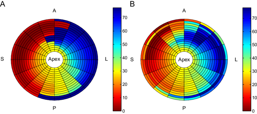 Bull's-eye Plots Of Depolarization Times From A Patient - Semantic Web (850x378), Png Download