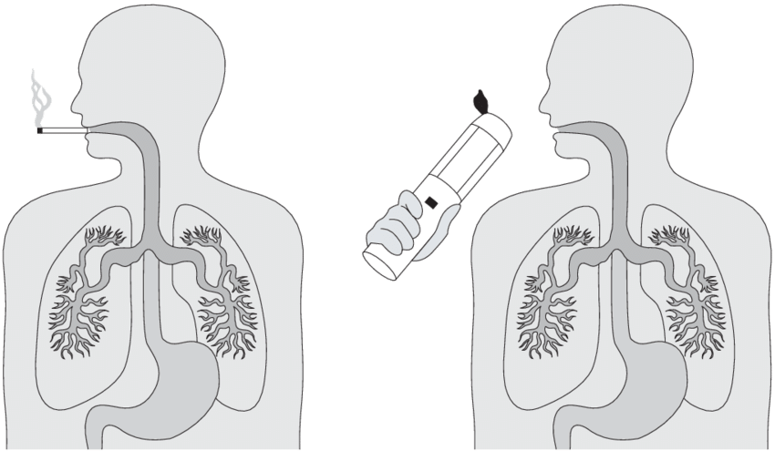Rationale For Pulmonary Delivery To Manage The Premetastatic - Illustration (850x495), Png Download