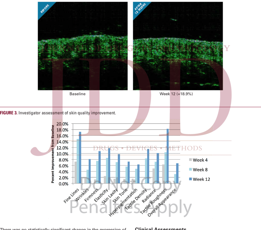 Ultrasound Image From Crow's Feet - Diagram (850x750), Png Download