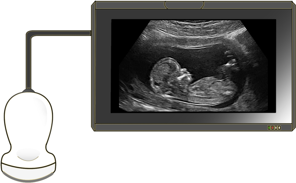Ultrasound - Cuarto Mes De Embarazo Ecografia (1000x616), Png Download