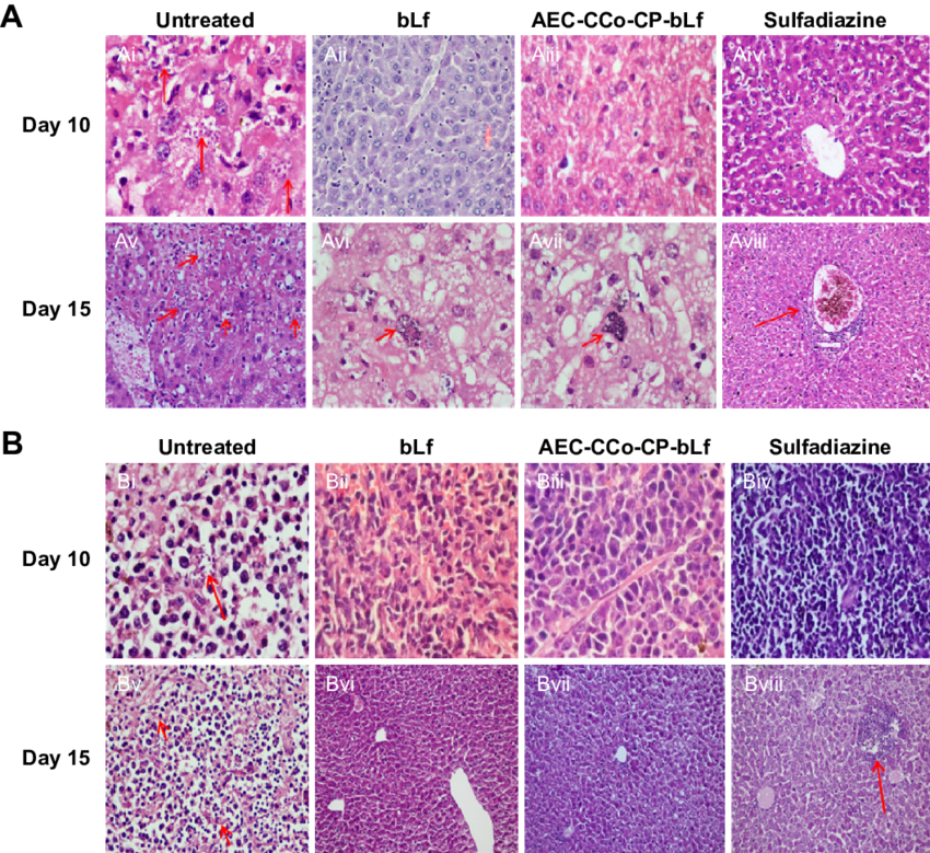 Histpathological Analysis In Liver And Spleen At Day - Art (850x779), Png Download