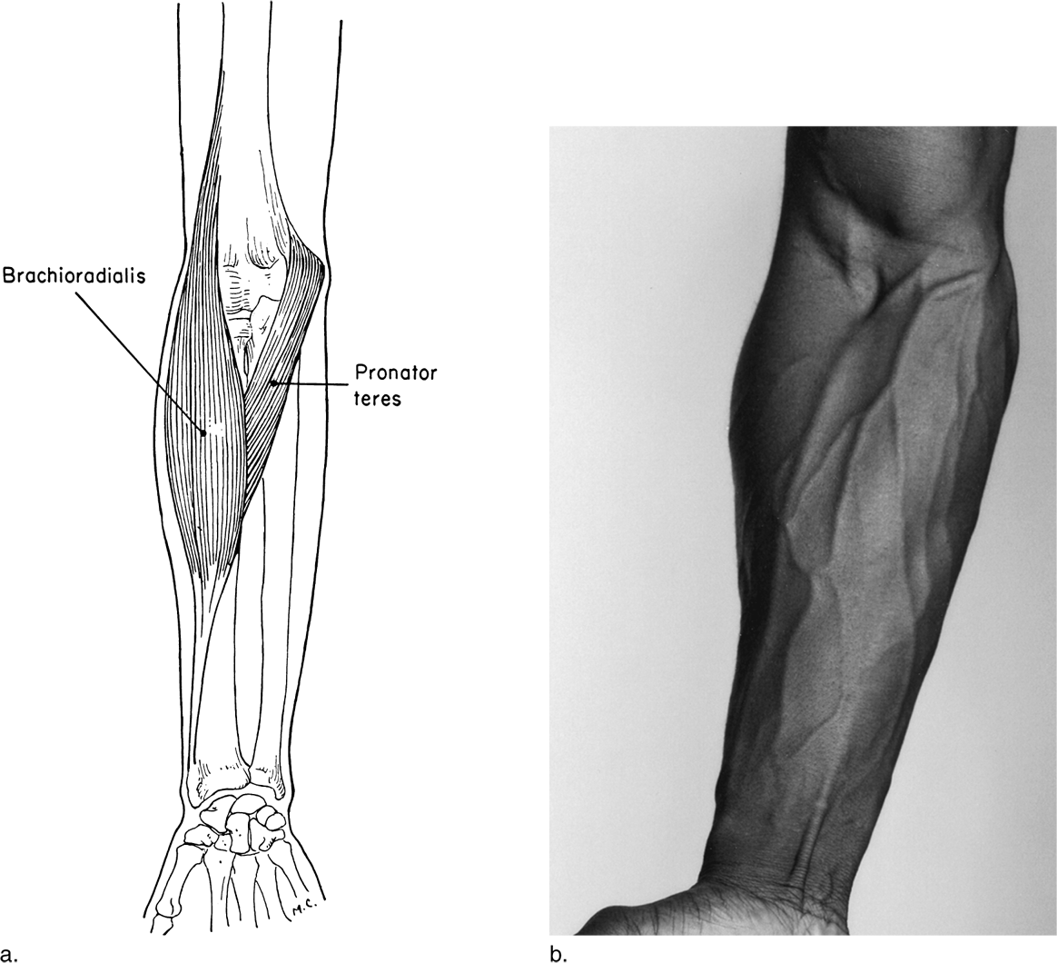 Image Not Available - Sketch (1164x1060), Png Download