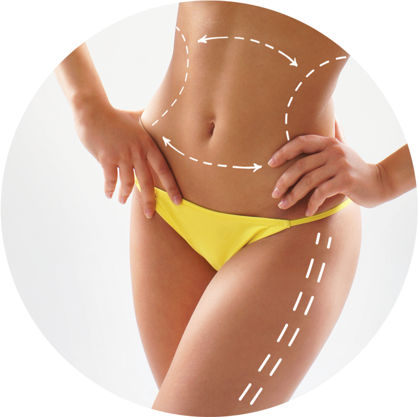 Weight Loss Trnsprntbckgrnd - Body Young Woman (1000x831), Png Download