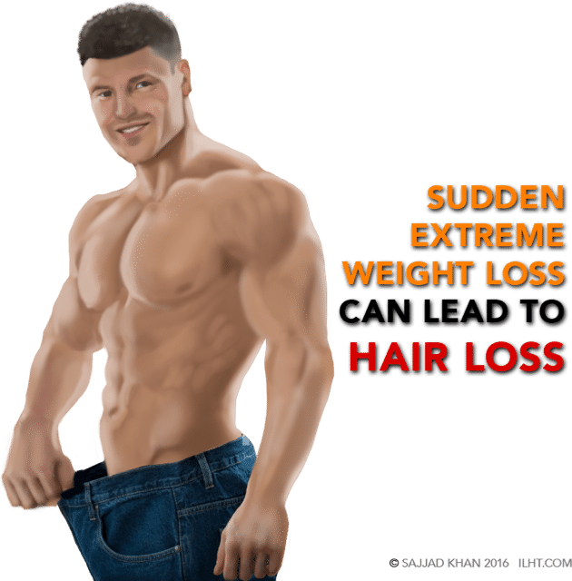 Nutritional Imbalance Or Deficiency - Weight Loss Man Png (630x640), Png Download