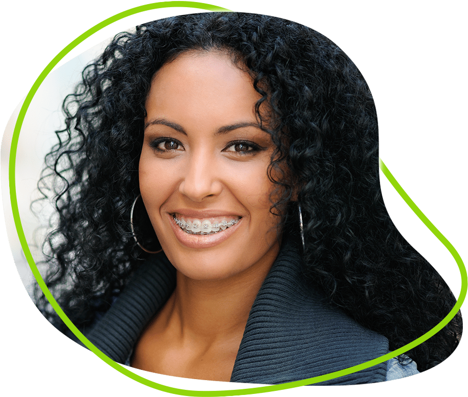 Ex Img - Braces Black Girl (993x794), Png Download