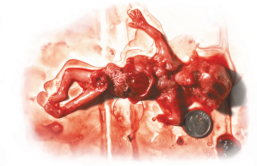 Free Png Download Not Your Body Abortion Meme Png Images - Marie Stopes Abortion Kenya (850x567), Png Download