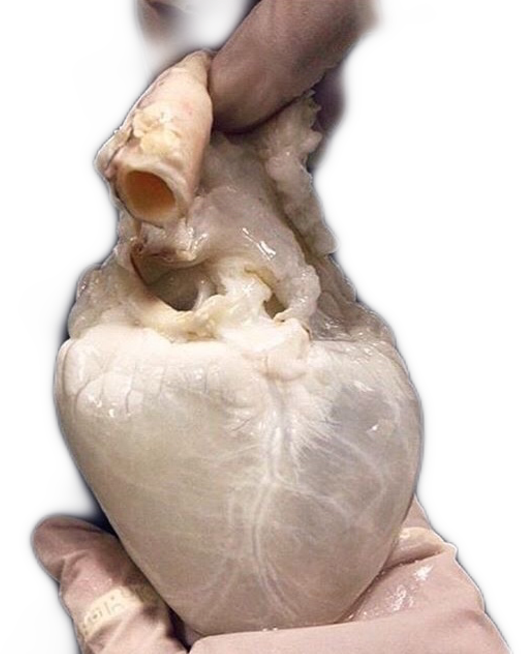 pix Human Heart Real Bleeding Heart Png human heart drained of blood png image