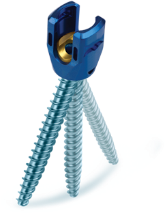 Uniplanar Screws - Globus Pedicle Screw (500x350), Png Download