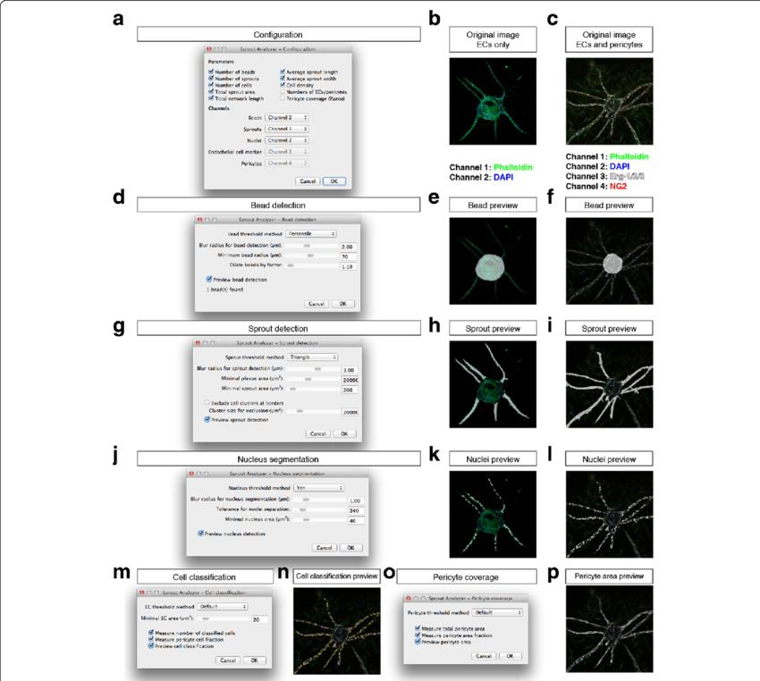 Configuration Of The Sprout Analyzer Plugin - Component Testing Using Cro (850x762), Png Download