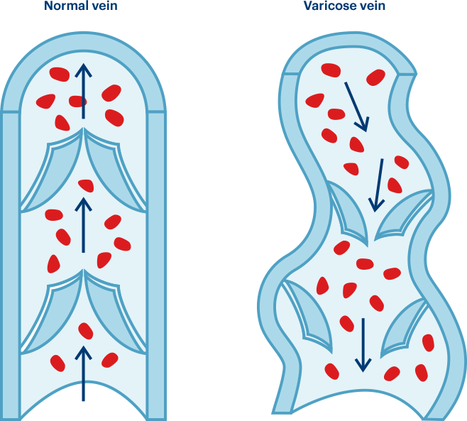 Comparaison Comparaison - Illustration (658x593), Png Download