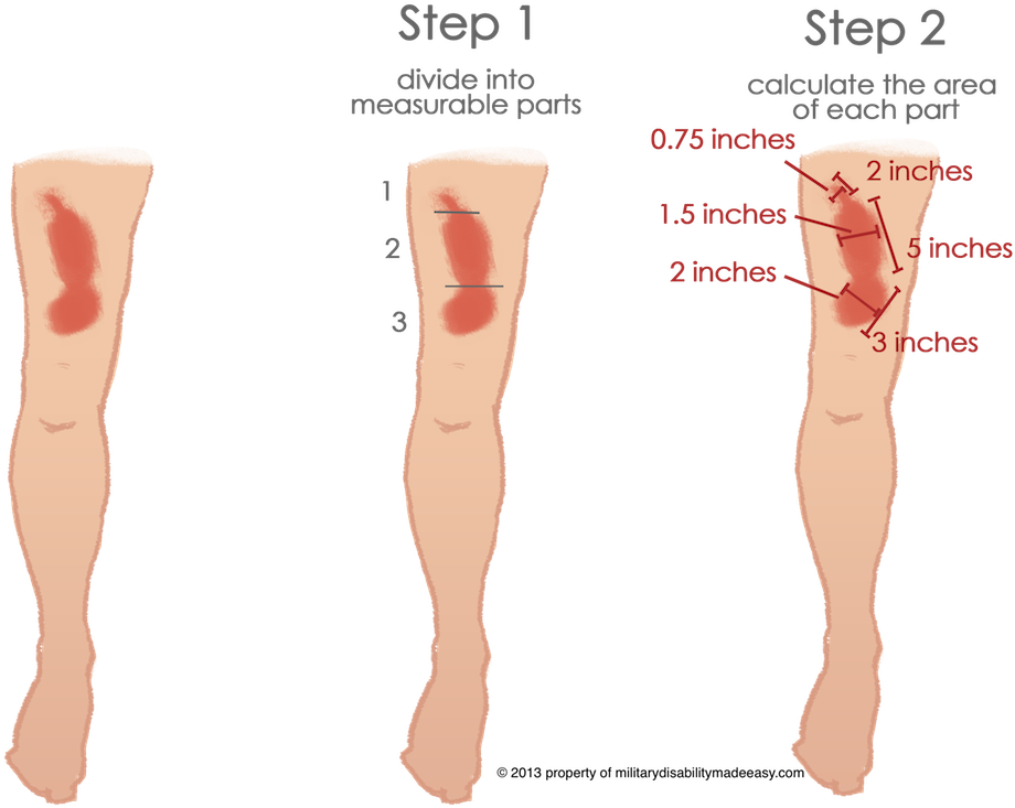 Scar Example 3 - Military Scars (927x739), Png Download