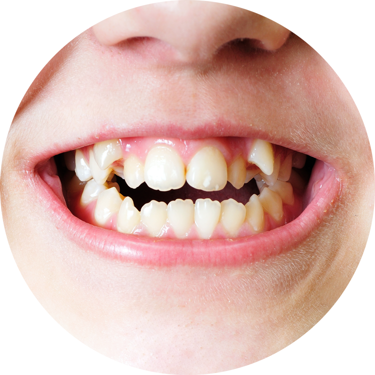 Common Related Problems Of The Teeth (750x750), Png Download
