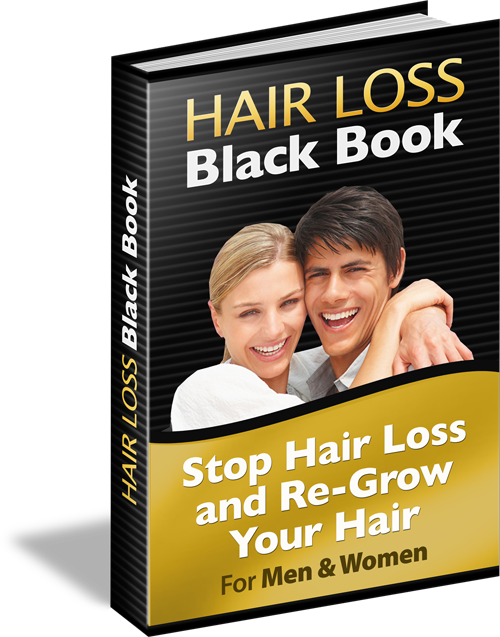 Hair Loss Black Book - Poster (500x637), Png Download