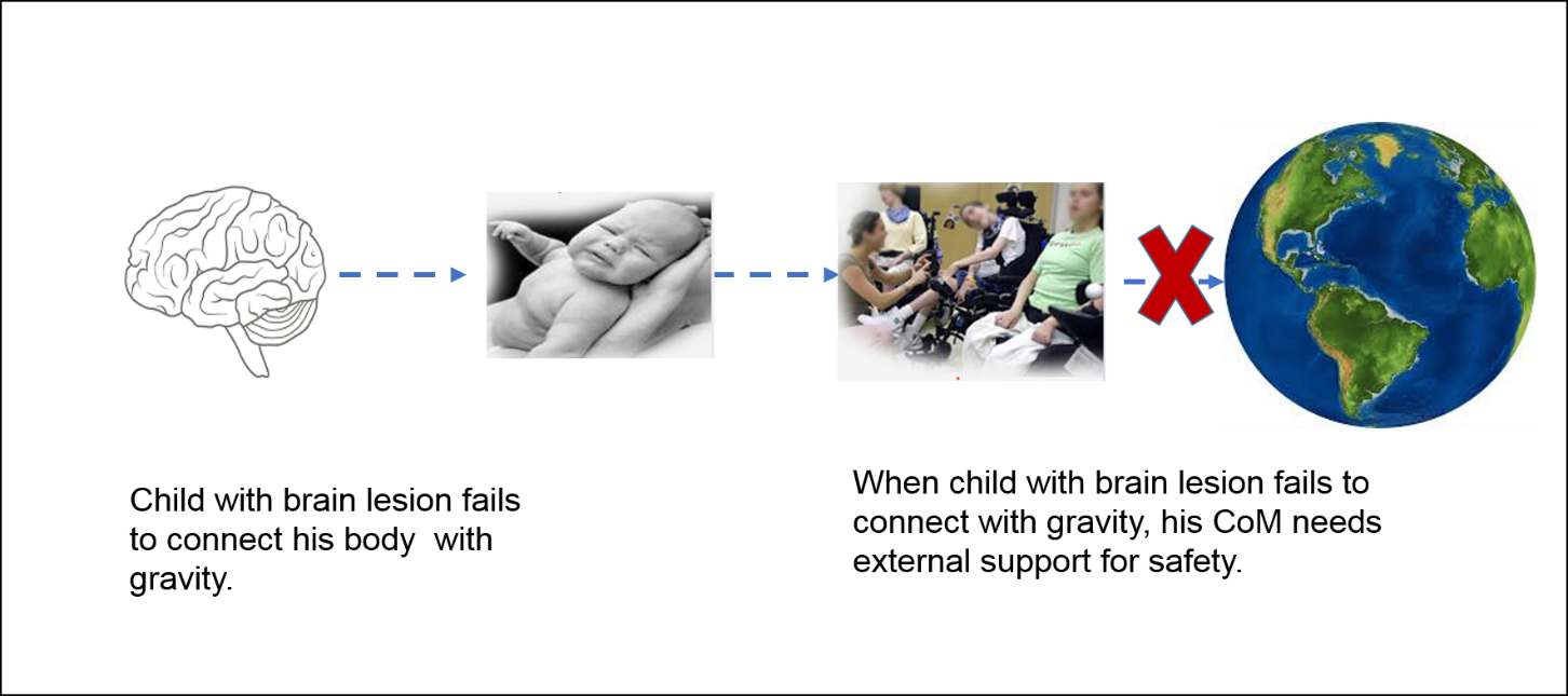 Child With Brain Lesion Can Not Connect To Gravity - Sphere (1452x645), Png Download
