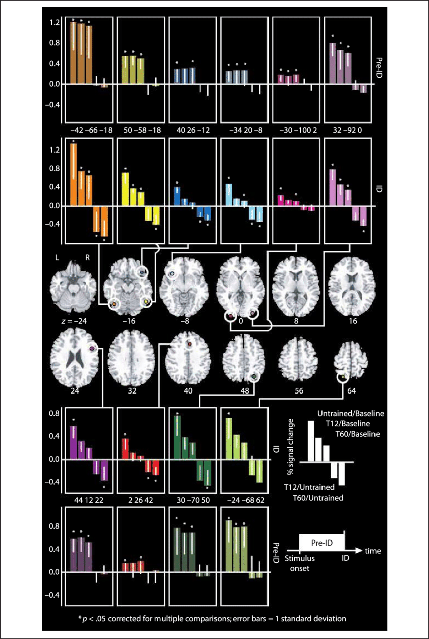 Percent Signal Change For Each Roi, Showing That Training - Broca Wernicke (850x1265), Png Download