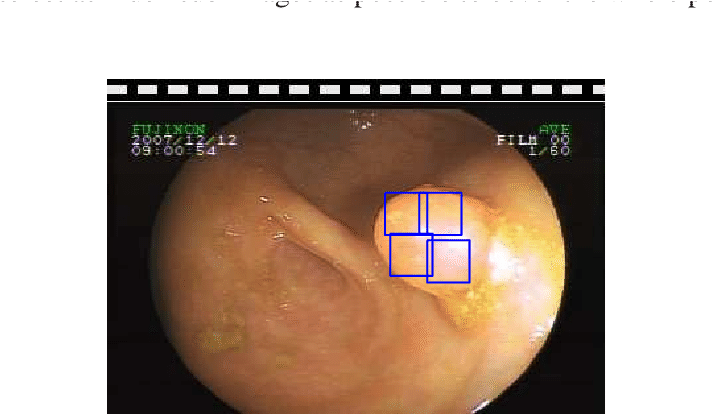 Polyps Sub-image Selection Is In General Not Overlapping - Planet (713x442), Png Download