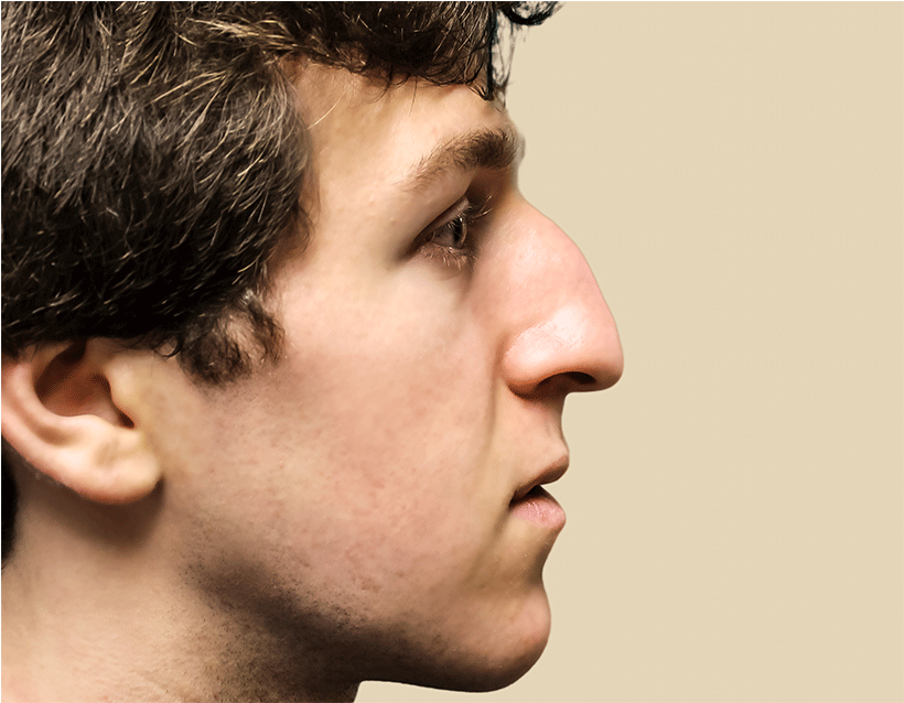 0004 Josh Katz Before Edit - Human (960x640), Png Download