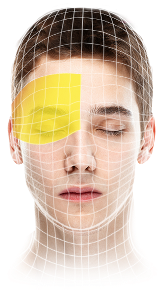 Cluster Headache - Human (646x593), Png Download