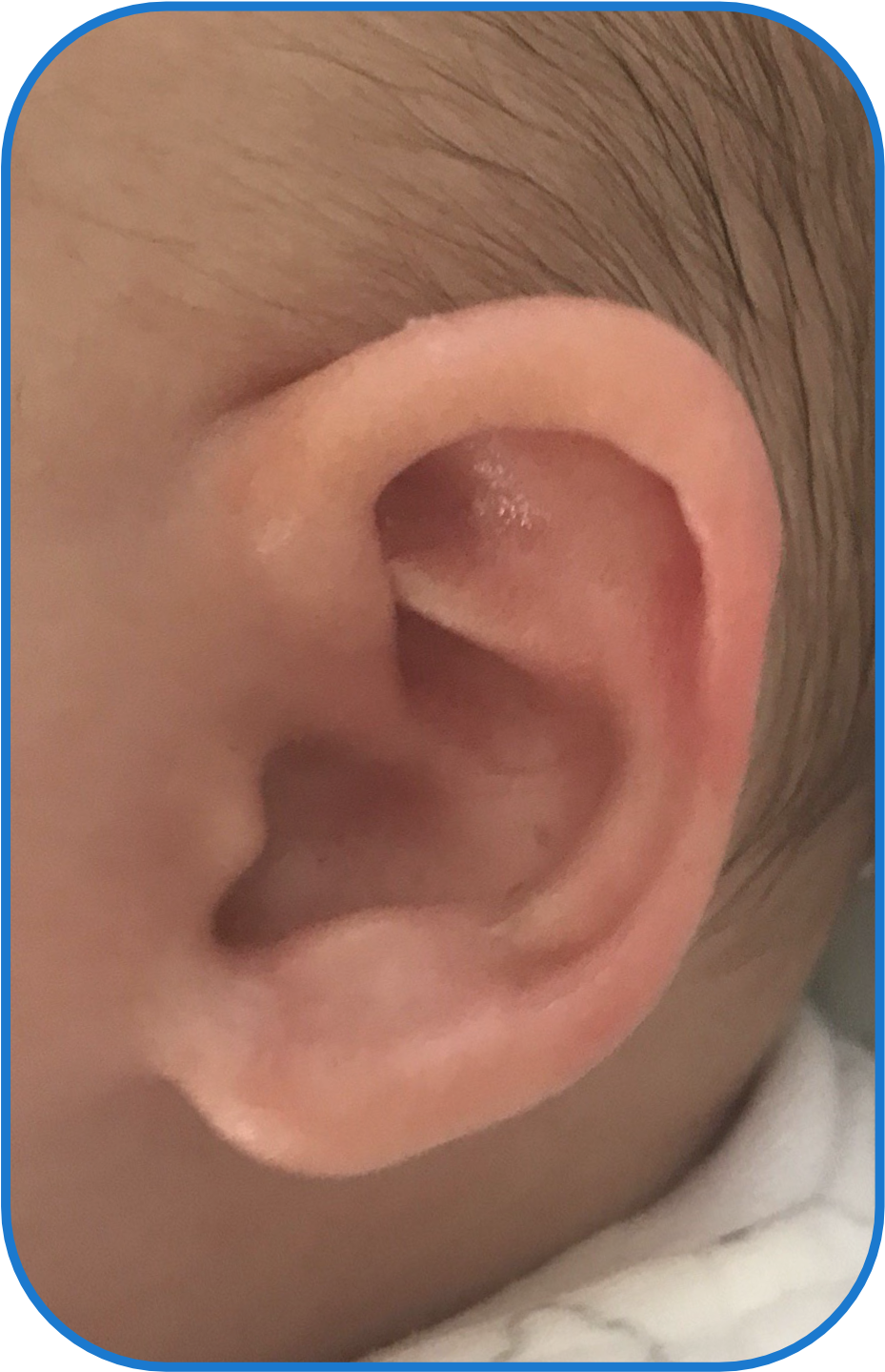 Ear Buddies Parent Review - Flesh (1050x1470), Png Download