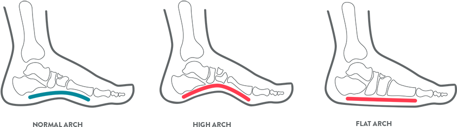 A Kids Foot Health Diagram Illustrating Arch Position - Foot Bones Kid (1285x360), Png Download