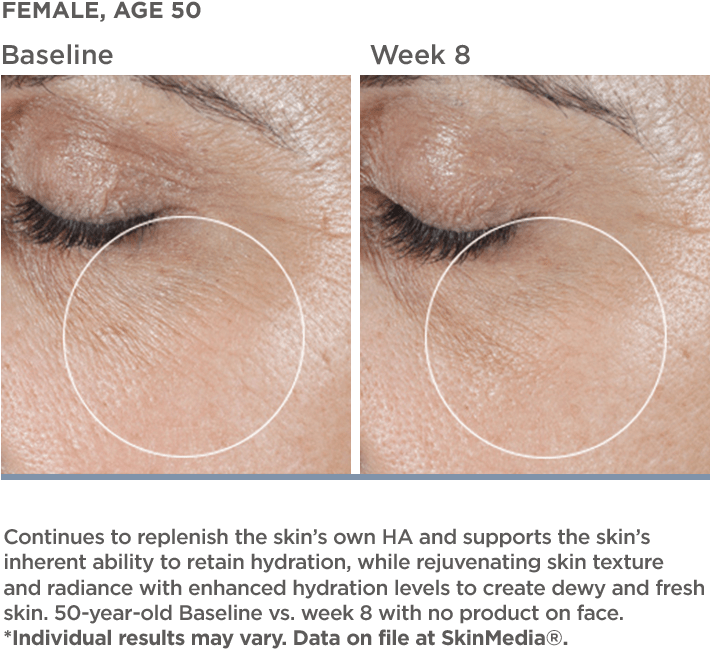 Results After 8 Weeks - 30 Year Old Skin Close Up (800x800), Png Download
