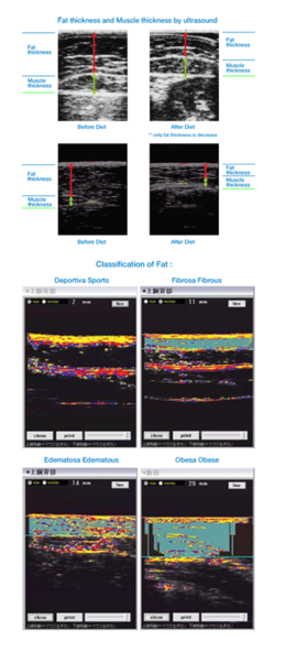 Download Weight Loss Clipart Green Coffee Extract Weight - Saptrees (260x591), Png Download