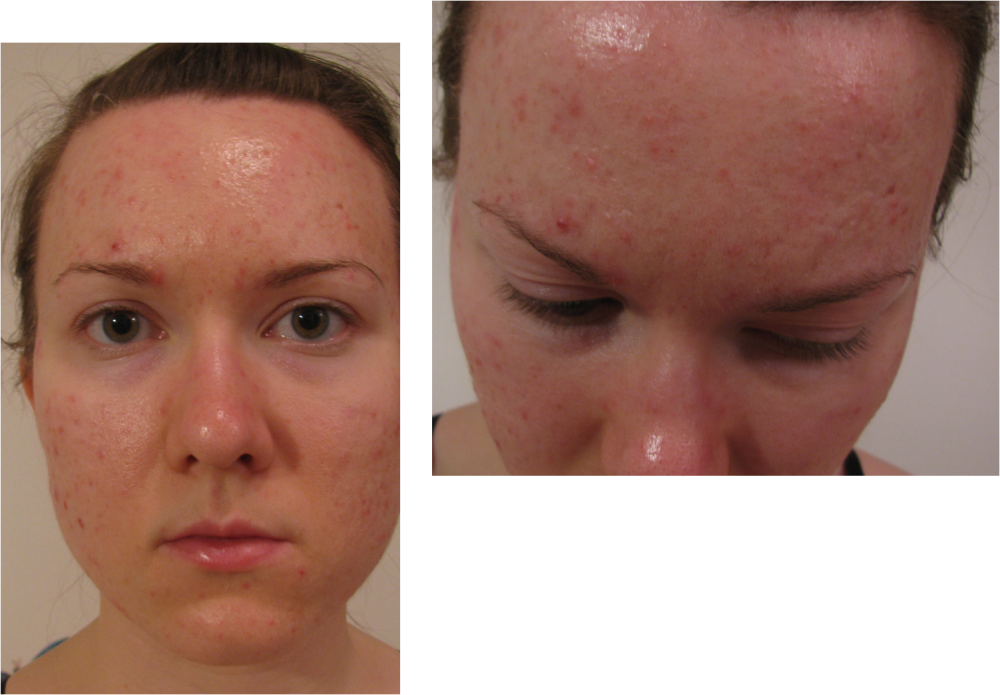 Picture23 - Scar (1000x695), Png Download