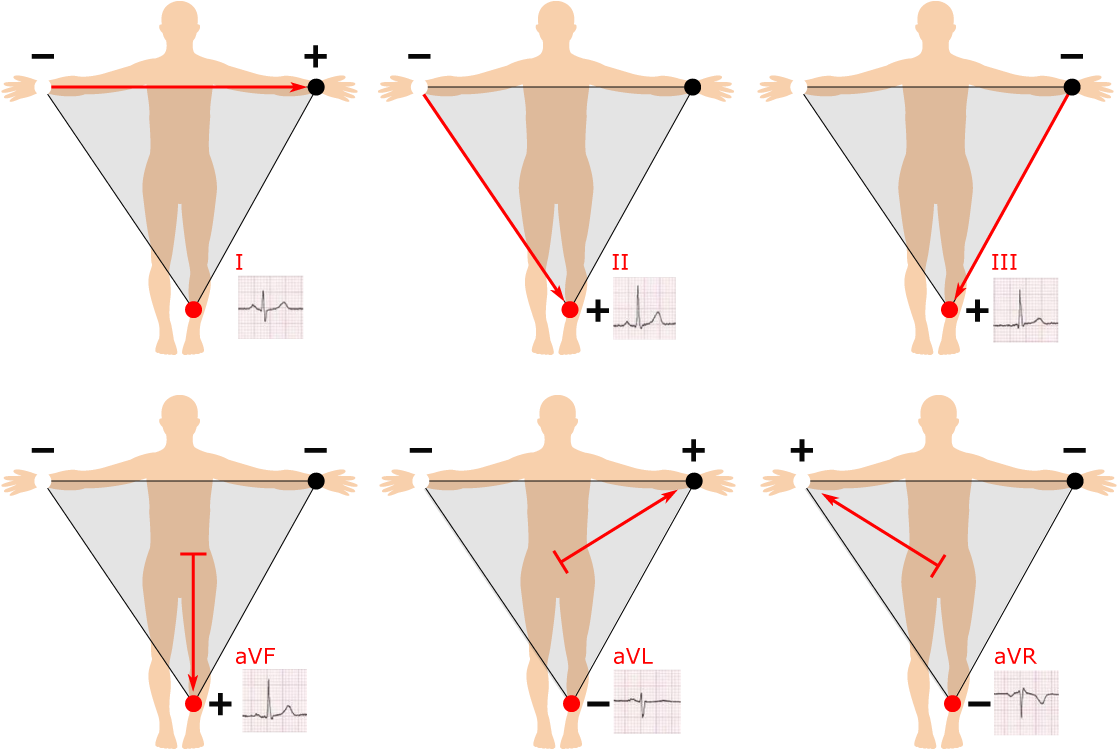 Einthoven's Triangle (1214x813), Png Download