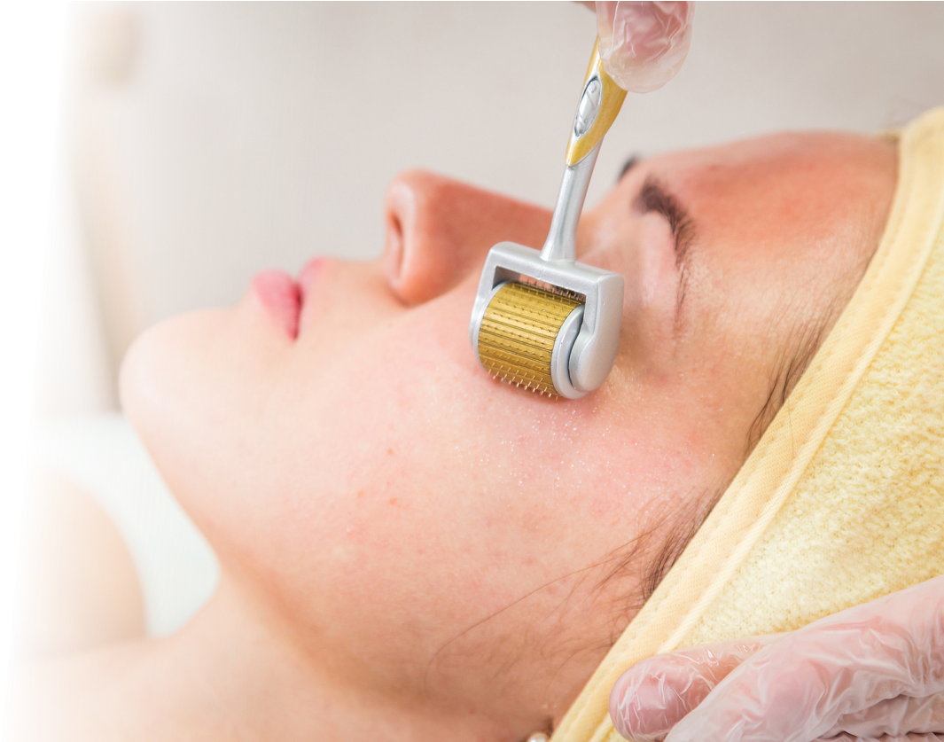 Tu Nuevo Aliado Contra Las Manchas La Aplicación De - Tratamiento Facial Con Dermaroller (1138x836), Png Download