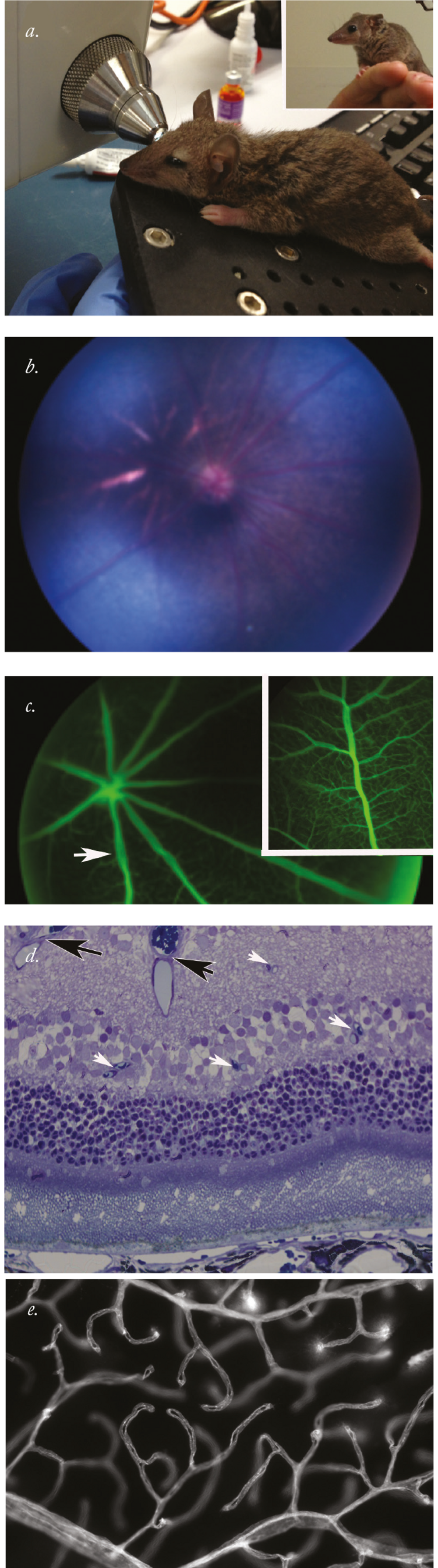 A Lesson From The Eye Of Marsupials - Laser (1000x3572), Png Download