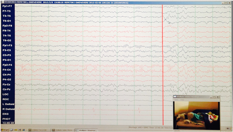 This Eeg Was Strikingly Different From Her Previous - Bedroom (830x490), Png Download