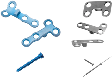 Foot And Ankle Metal Plates And Screws 1 Large - Metal Plate And Screws In Knee (400x370), Png Download