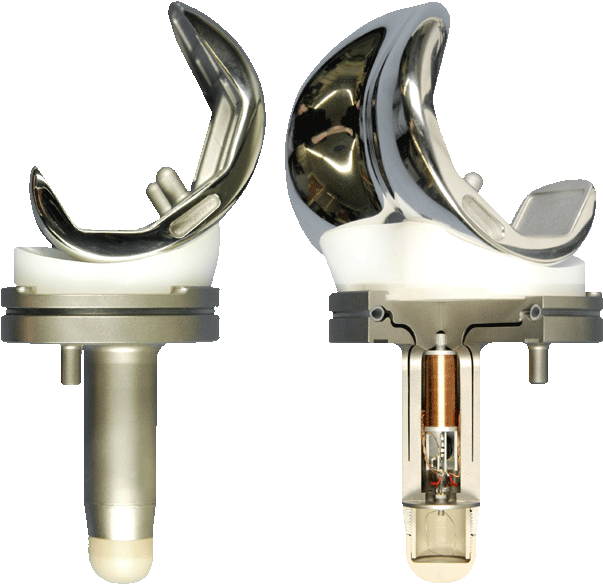 File - Knieprothese - Total Joint Prosthesis Depuy (700x700), Png Download