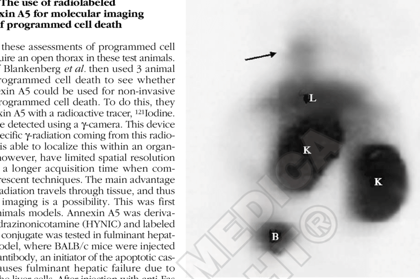 Arrowhead Points Out Uptake Of Technetium Labeled Annexin - Number (850x566), Png Download