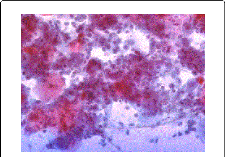 Yeast And Hyphae In Distal Esophagus Brush - Esophagus (769x536), Png Download