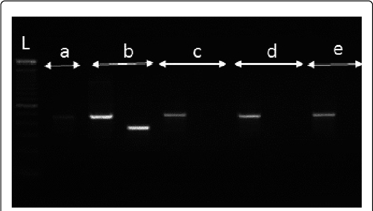 Photograph Of A Gel Showing The Separated Pcr Products - Monochrome (769x435), Png Download
